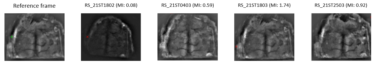 align_tt_autoalign_summary_fig