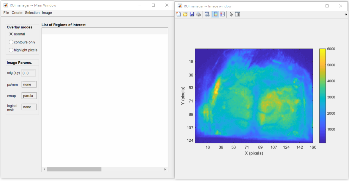 align_tt_roimanager_fig1