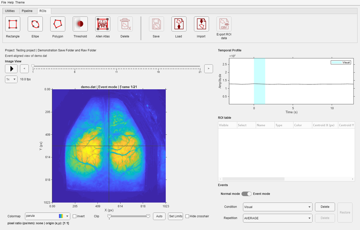 DataViewer event-aligned view
