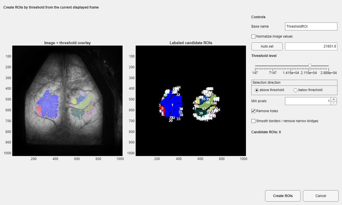 Threshold-based ROI creation dialog