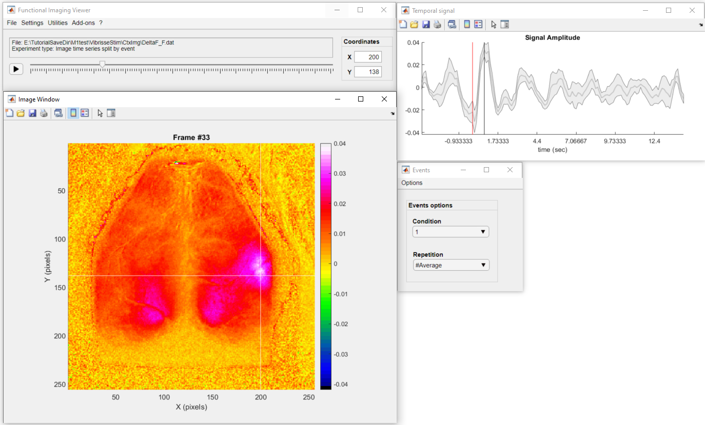 roimanager_thresholdapp_data_overview2