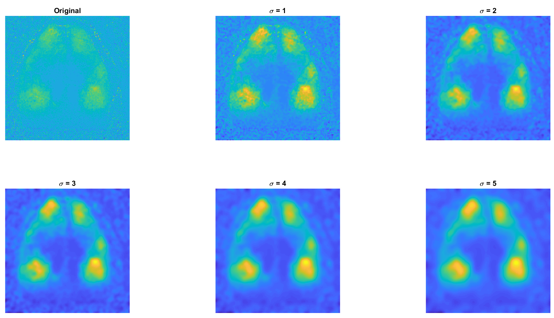 spatialGaussFilt_sigma_example