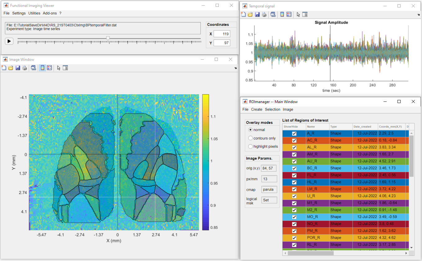 tt_extracting_data_from_rois_dataviewer_tempFilt_with_rois